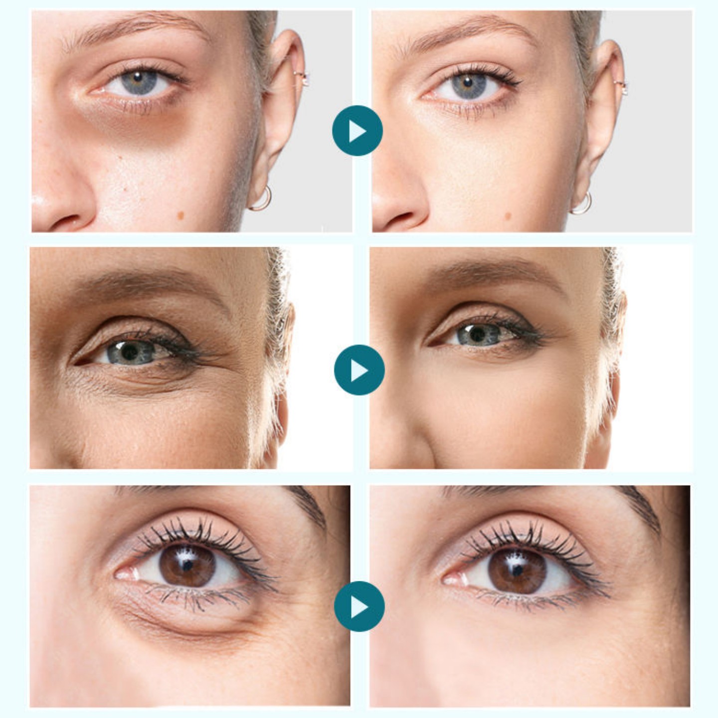 MLB's own brand soluble anti-wrinkle and dark circle removal Centella Crystal Collagen Eye Gel Patch Eye mask Application Scenario