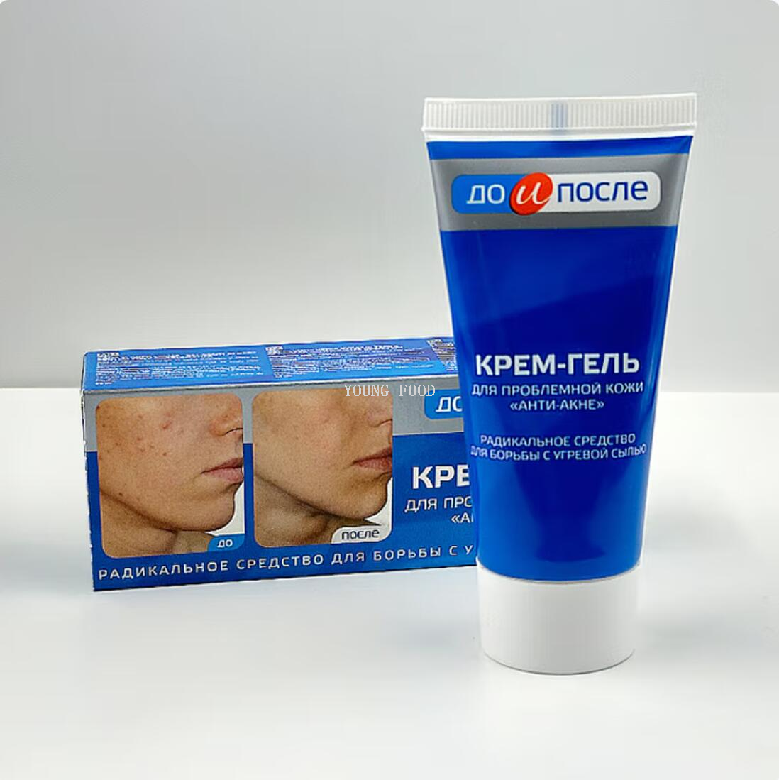 Free shipping Russian Front/Back Acne Repair Cream 50ml Skin Care and beauty SILMPLY GENTLE