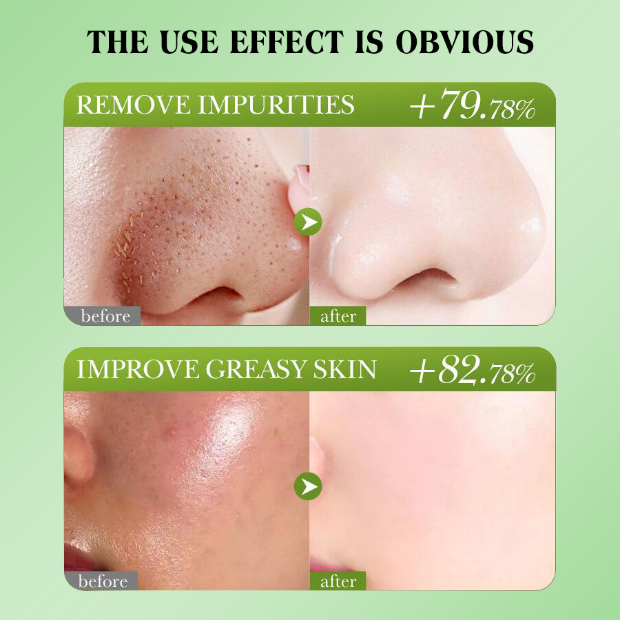 Dear She Bamboo charcoal peel-off mask: Remove blackheads, clean mud mask, shrink pores. Apply the mask Item Picture