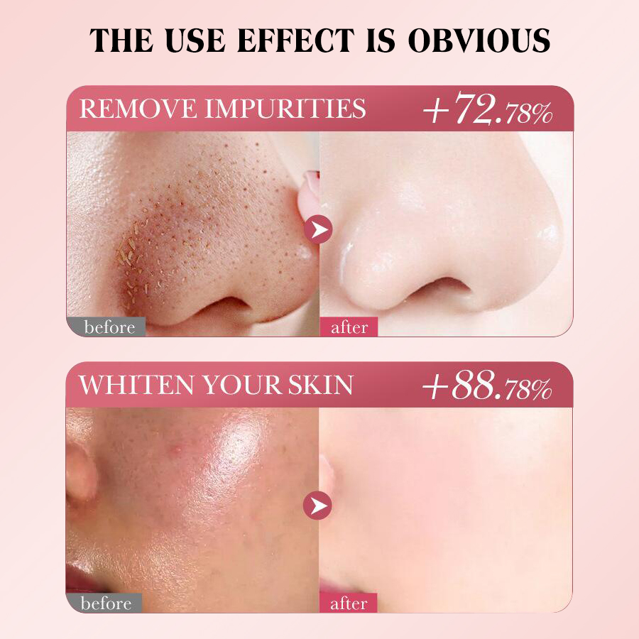 Dear She Starry Sky Mask Peel-off Cleansing, Moisturizing and Nourishing Mask (Cross-border) Item Picture