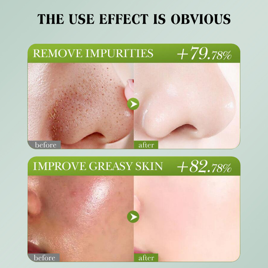 Dear She Starry Sky Peel-off Cleansing Hydrating Mask Wholesale Cross-border multiple styles to choose from Item Picture