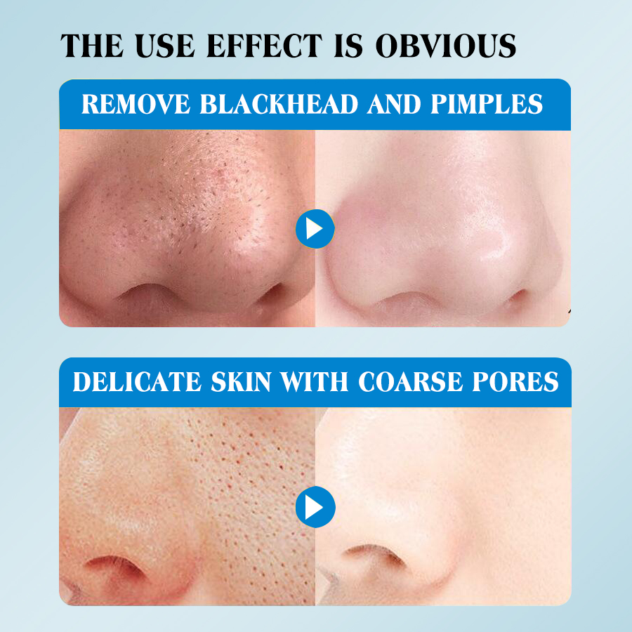 تمزيق قماش الوجه بواسطة تجفيف عميق في سماء النجوم Item Picture