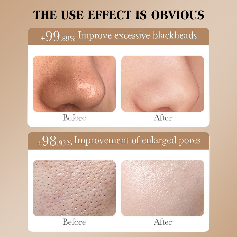 Querido ella máscara de café piel limpia snow muscle ripple mask brillo limpieza profunda hombres y mujeres productos de cuidado de la piel Application Scenario