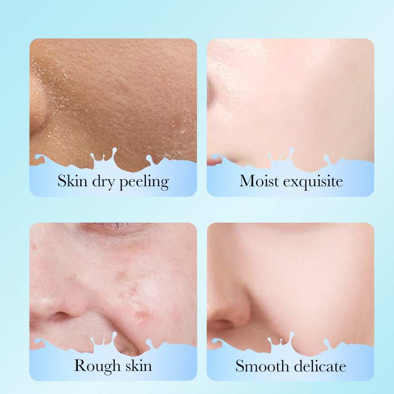 Dear She Milk Blackhead and Acne Mask, Blackhead Removal Nasal Mask, Peel-off Blackhead Removal Mask Item Picture