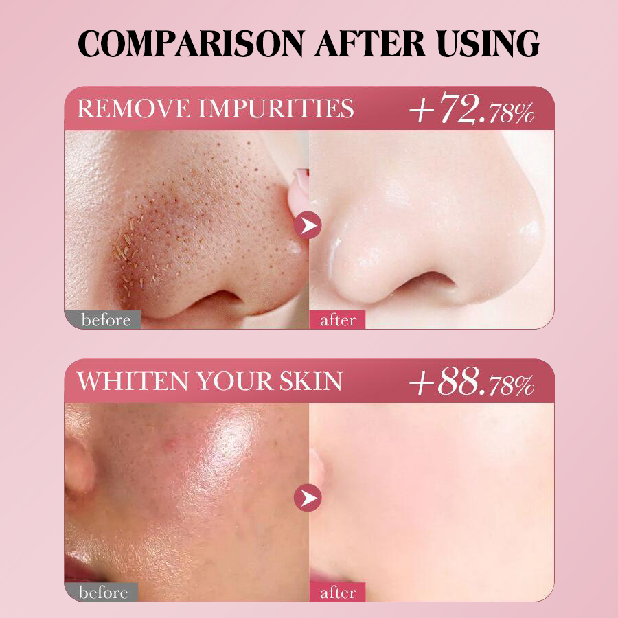 Dear She Rose Mud Mask Hydrating Moisturizing Cleansing Mask Cream Cross-border Exclusive Supply Item Picture
