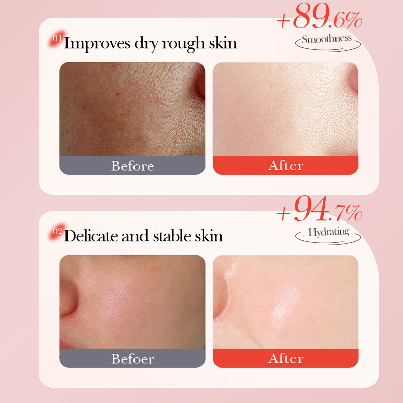 DEAR SHE Strawberry Moisturizing Mask: Moisturizing, Hydrating, Brightening complexion. Cross-border factory wholesale Application Scenario