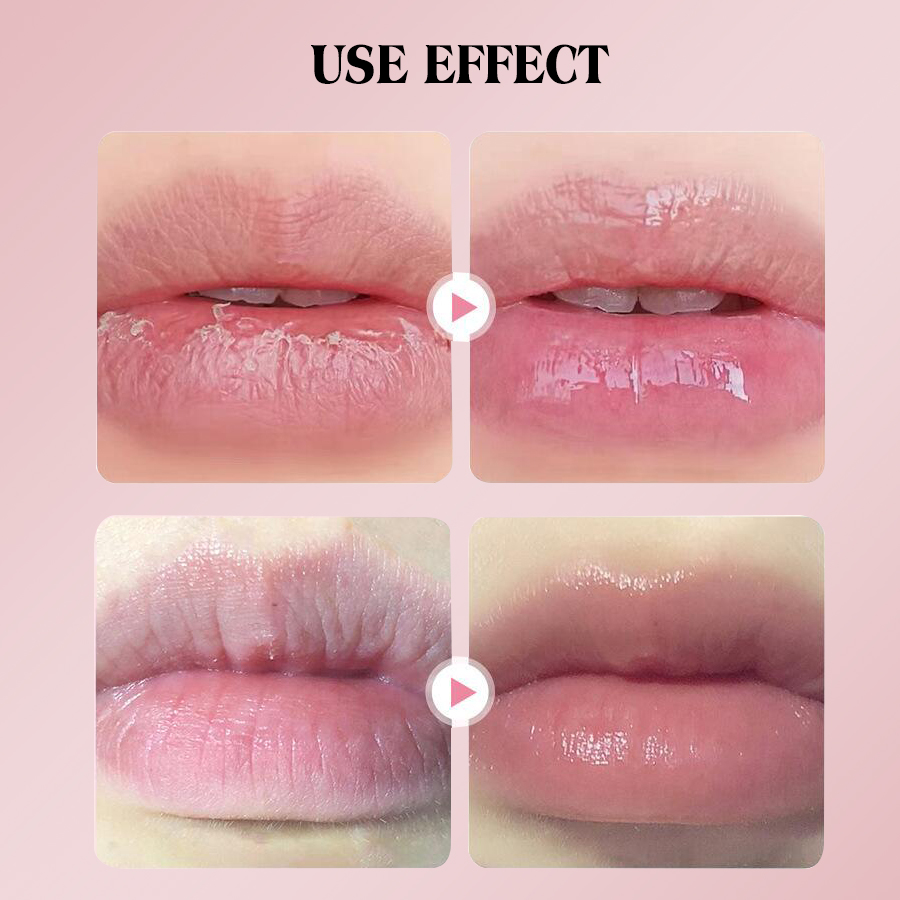 DEAR SHE Collagen Lip Mask Moisturizes, nourishes, reduces lip lines and Lip Care wholesale Item Picture