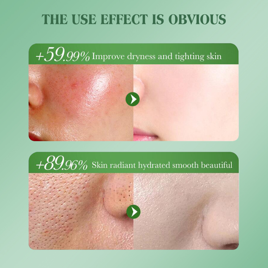DEAR SHE Cross-border Cucumber Essence Gel Mask Hydrating and Moisturizing Mask Wholesale Customization Application Scenario