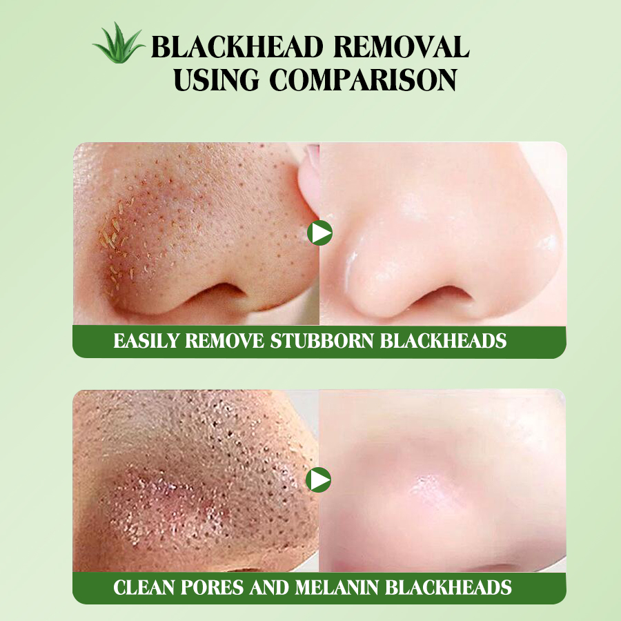 DEAR SHE Aloe Vera Nose Mask Deeply cleanses pores and removes blackheads. Peel-off T-zone care mask Item Picture