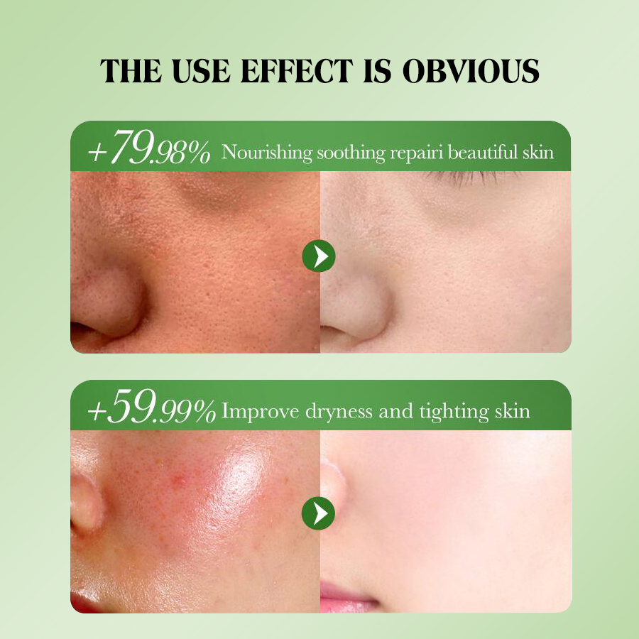 DEAR SHE Aloe vera Gel Hydrates and soothes Aloe Vera Gel Moisturizes and rejuvenates the skin Application Scenario
