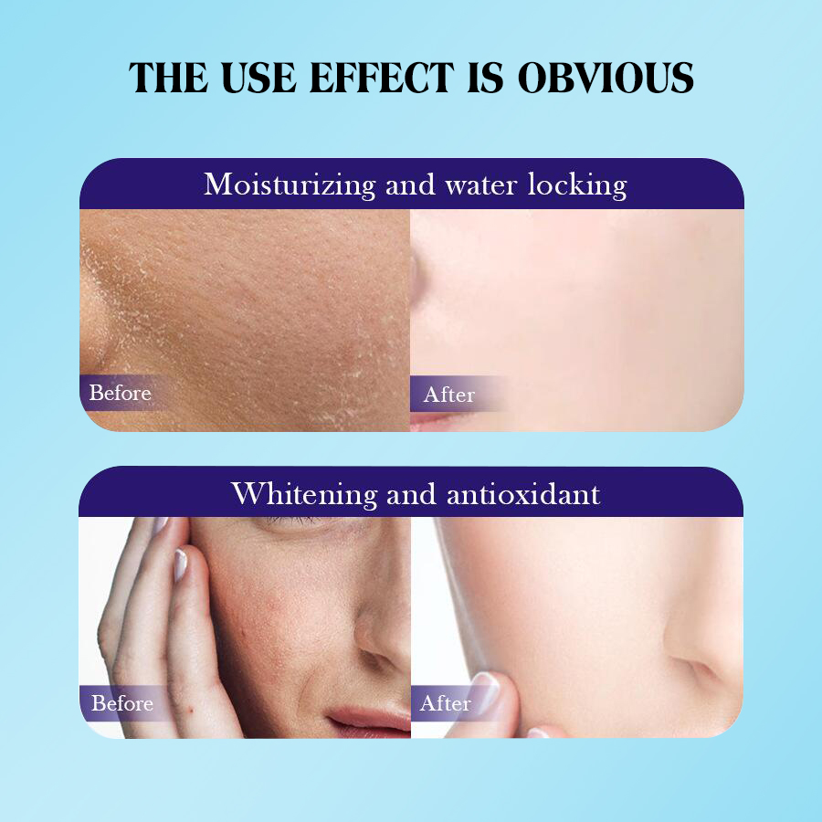 Dear She Snail Essence Facial Moisturizing and Nourishing Gel Mask Hydrates, Moisturizes and Tighens the skin Cross-border export Application Scenario
