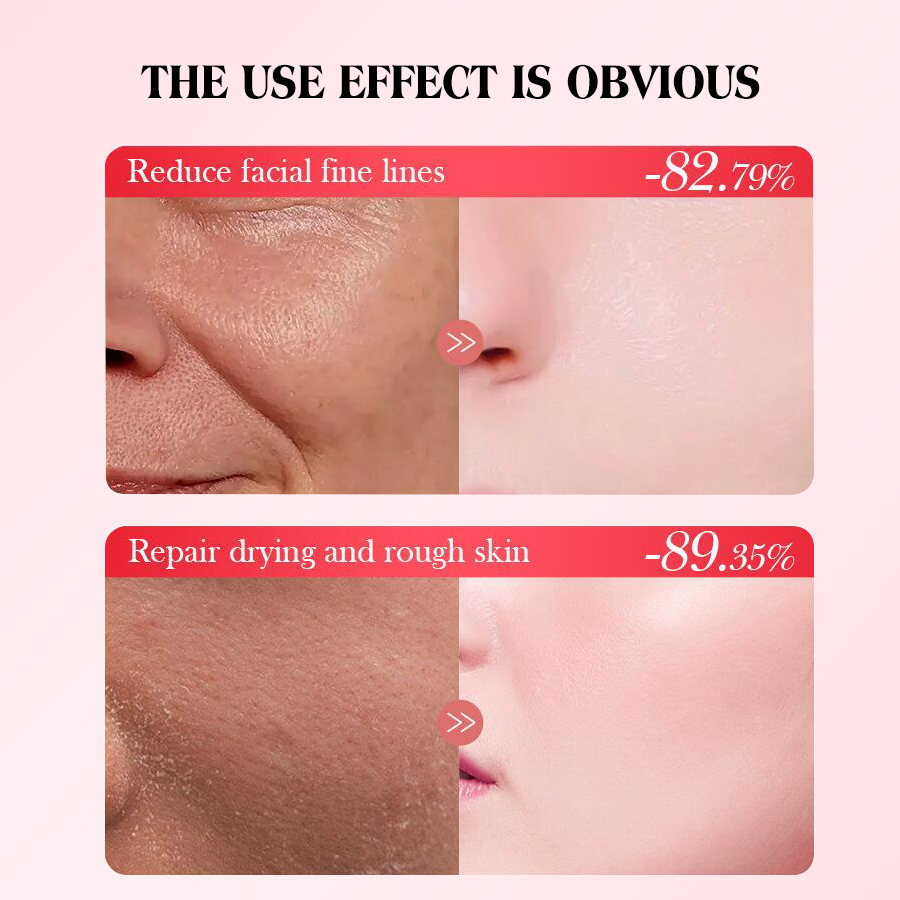 DEAR SHE Milk Peach Gel Face Cream Mask Moisturizing, Hydrating, Nourishing and rejuvenating Cross-border Wholesale Application Scenario