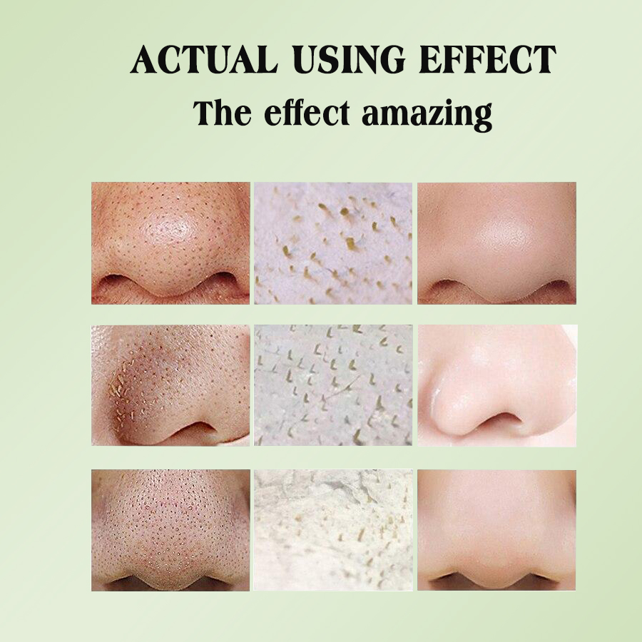 Dear she Olive Nose Patch Deep Cleansing Blackhead Removal Nose Patch Peel-off Blackhead Removal Patch Specification image