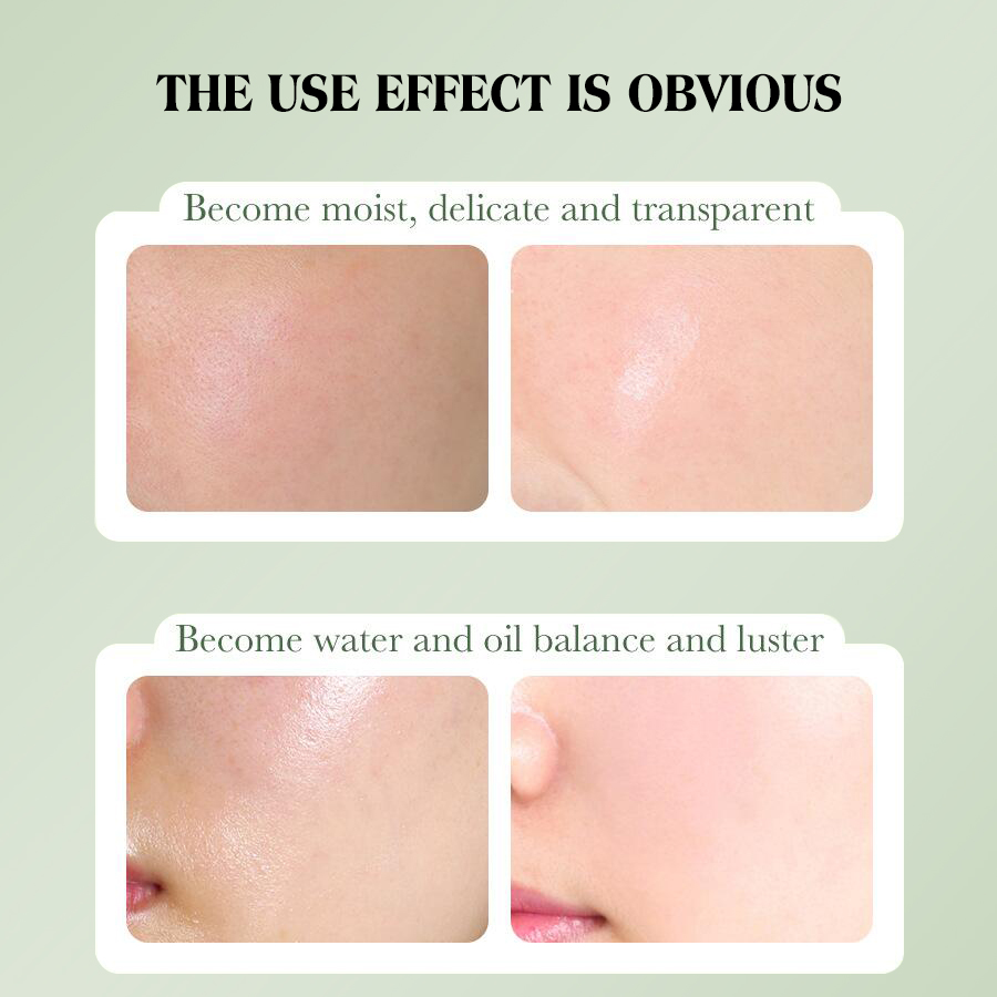 DEAR SHE Avocado Cream Gel Deep Hydrating Moisturizing Moisturizing Non-Greasy Facial Essence Cream Application Scenario