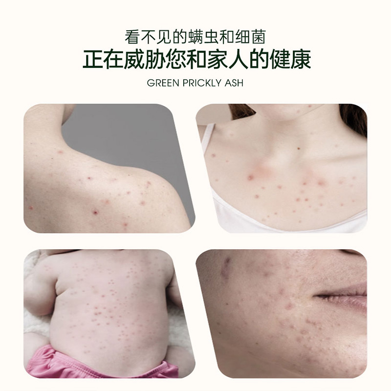 Linglexi Green Pepper Mite Remover Spray for Bed and Quilt Home Insecticide 蝻 agent no-rinse Mite Remover Wonder 3 bottles Application Scenario