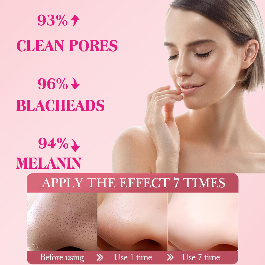 DEAR SHE: Three-step Blackhead Removal Nasal Mask to Clean pores. Blackhead removal nasal mask to moisturize details Picture