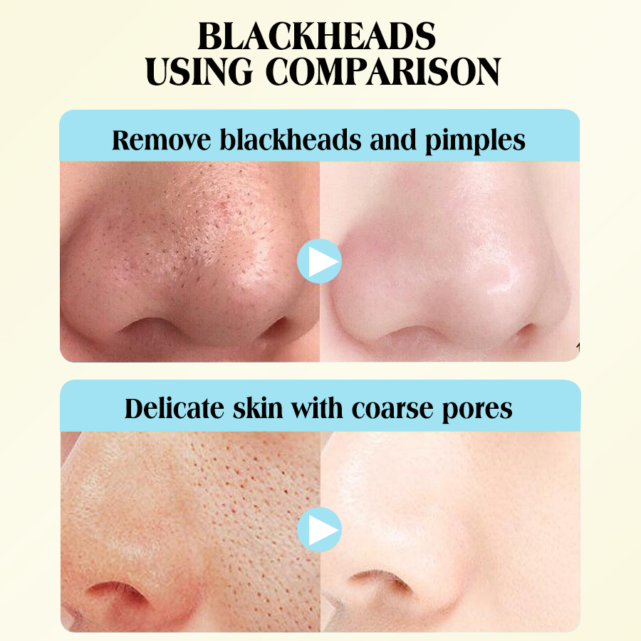 DEAR SHE Lemon Blackhead Removal Nasal Mask Three-Step Pore Cleansing Blackhead Removal Moisturizing Nasal Mask Specification image
