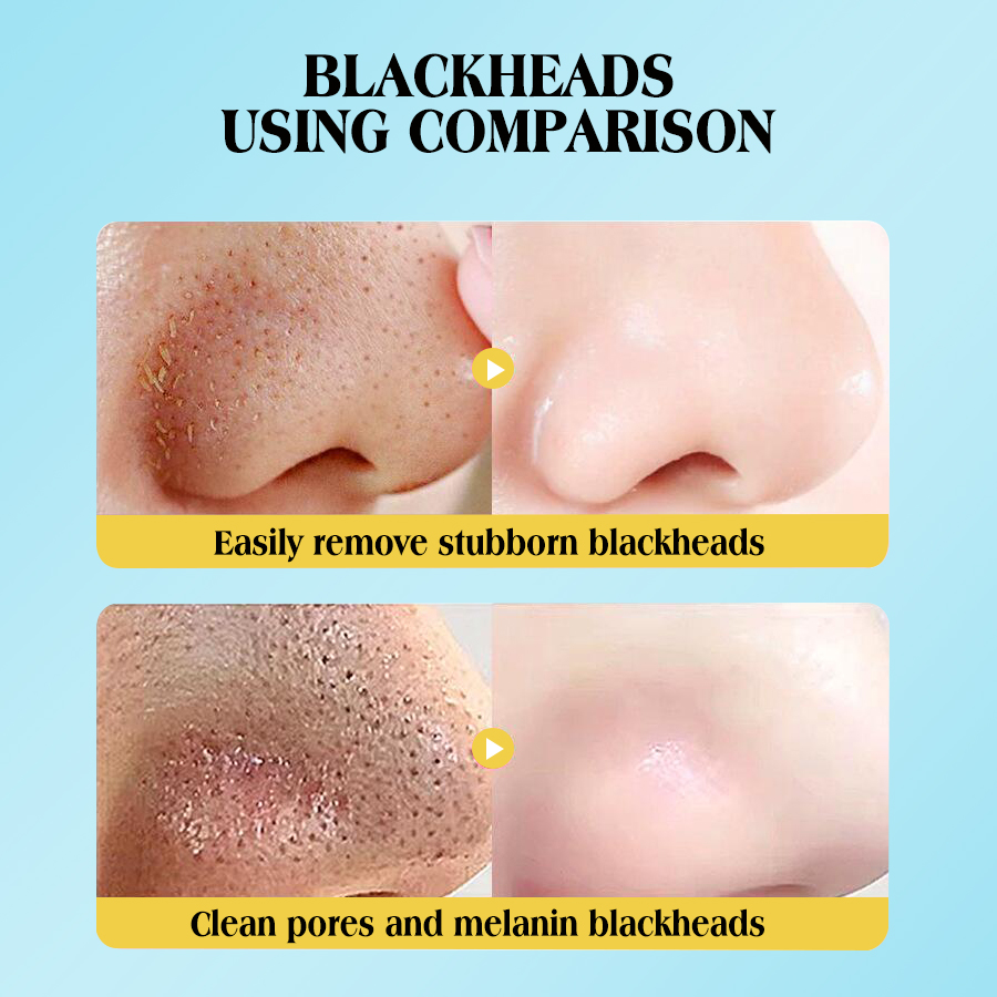 DEAR SHE Bamboo Charcoal Blackhead Nose Mask Deep Cleansing Blackhead Removal Mask Blackhead Killer Specification image