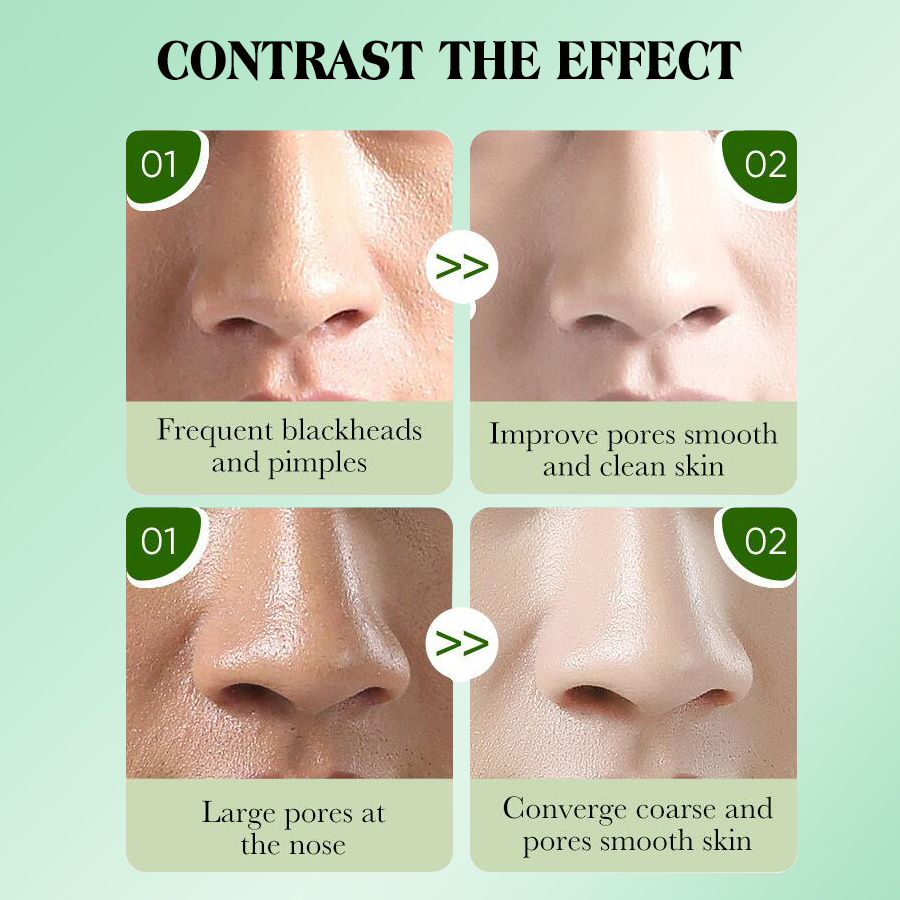 DEAR SHE Aloe Vera Blackhead Nose Mask Deep Cleansing Blackhead Removal Mask Blackhead Killer Specification image