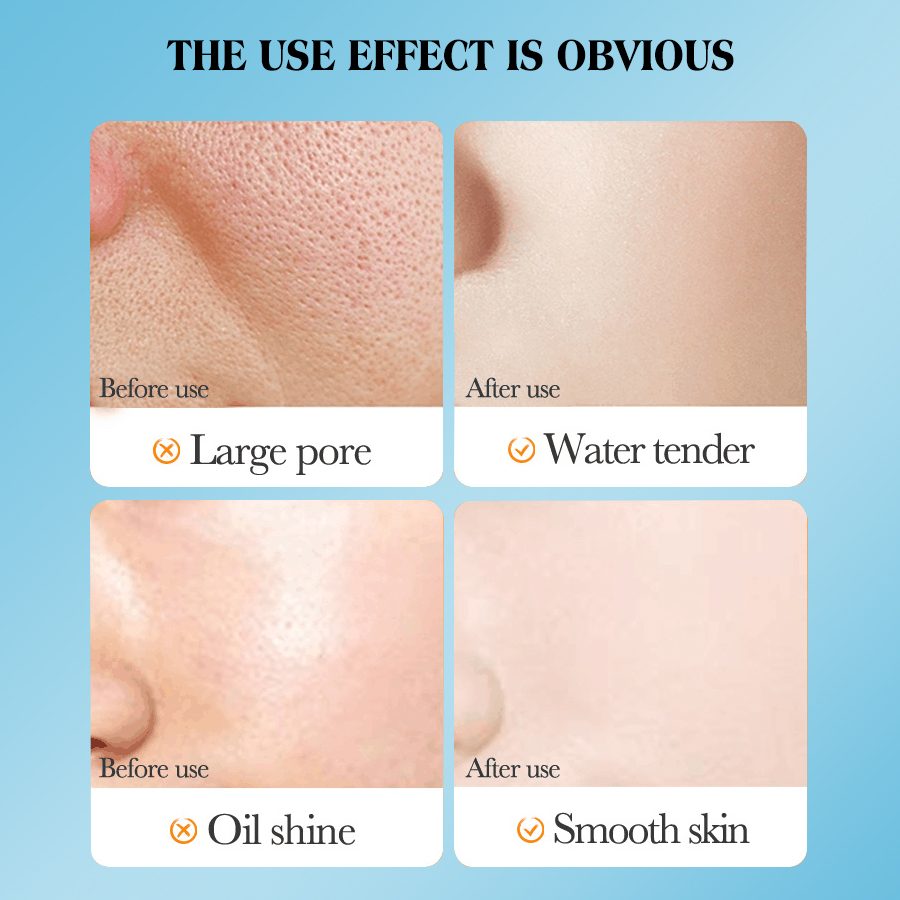 DEAR SHE Black Sea Salt Blackhead Absorbing Bubble Deep Cleansing Blackhead Removal Mask Patch Cross-border Wholesale Item Picture
