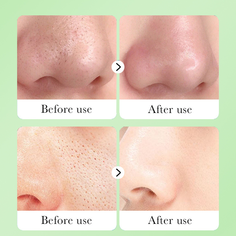 Dear She Cucumber Blackhead Removal Mask Peel-off Blackhead Removal and Acne Removal Black Mask Factory Direct Sale Item Picture