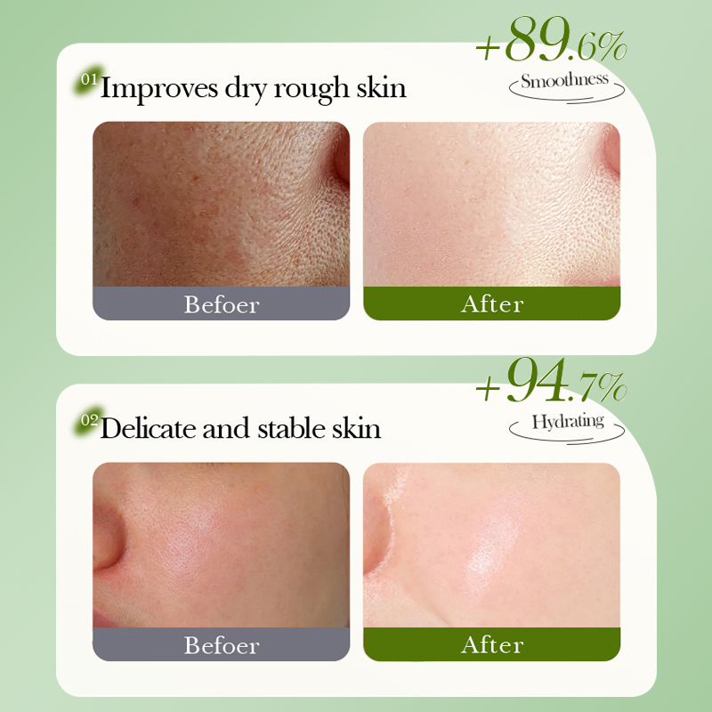 DEAR SHE Fruit Avocado Deep Cleansing, Moisturizing, Blackhead Removal, Smooth Facial Skin Peel-off Mask Application Scenario