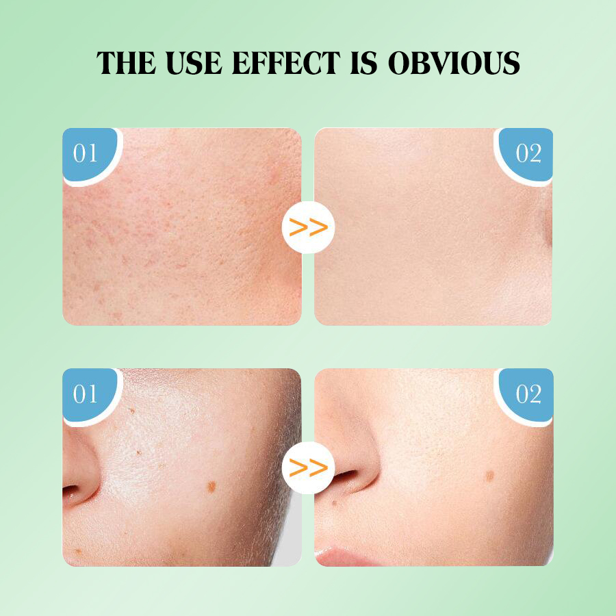 يتم تنظيف أغشية الفقاعات عبر الحدود في OEM/ODM مع تركيبها حسب الطلب Item Picture