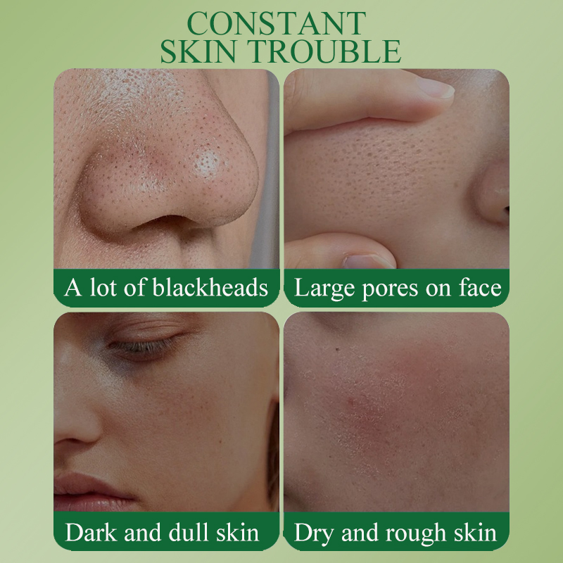 DEAR SHE Aloe Vera Essence Clay Cleansing Mask Moisturizes, Repairs, Removes Blackheads, Cleans pores, Factory customized Specification image