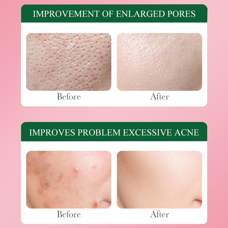 Dear She Rose Leave-in Sleeping Mask Cream Hydrating Moisturizing Mask Cross-border Exclusive Supply Factory Customizable Item Picture
