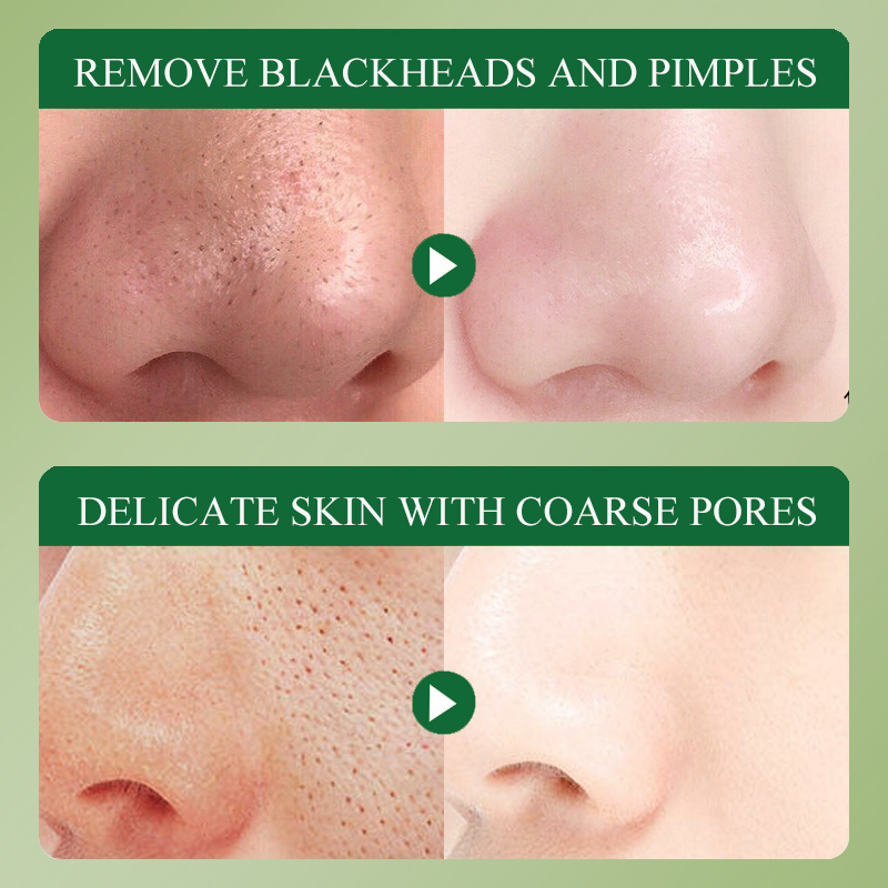 DEAR SHE Aloe Vera Essence Clay Cleansing Mask Moisturizes, Repairs, Removes Blackheads, Cleans pores, Factory customized Item Picture