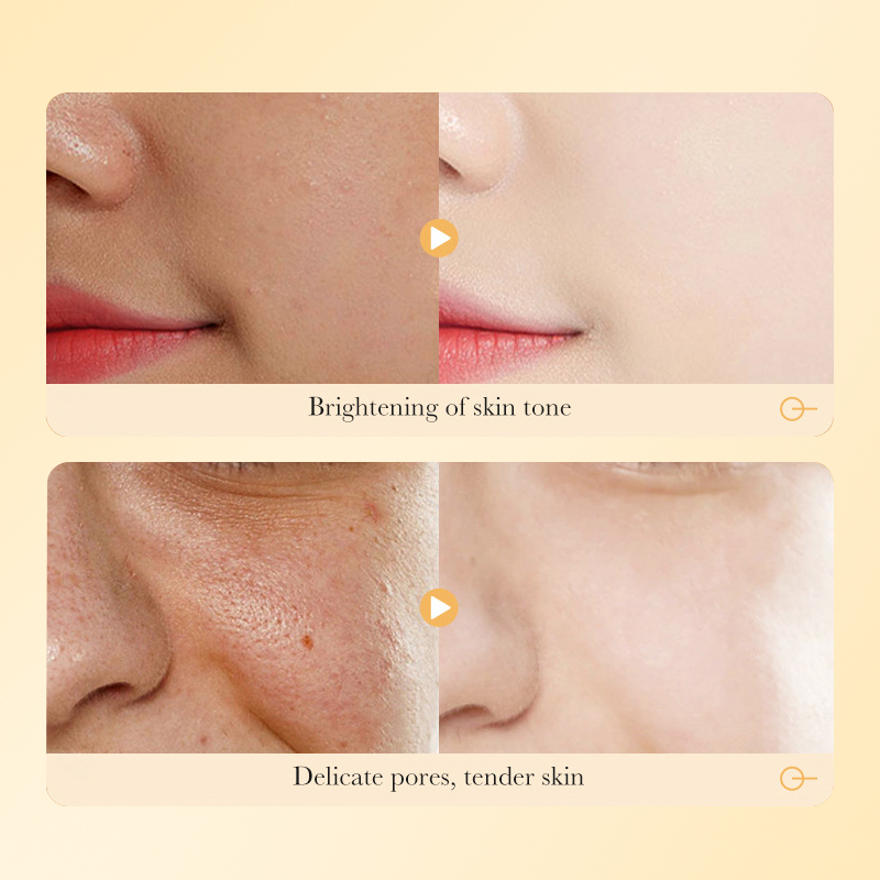 DEAR SHE 10PCS Gold Collagen Ampoule Mask Moisturizing, Hydrating and rejuvenating Cross-border Export Wholesale Item Picture