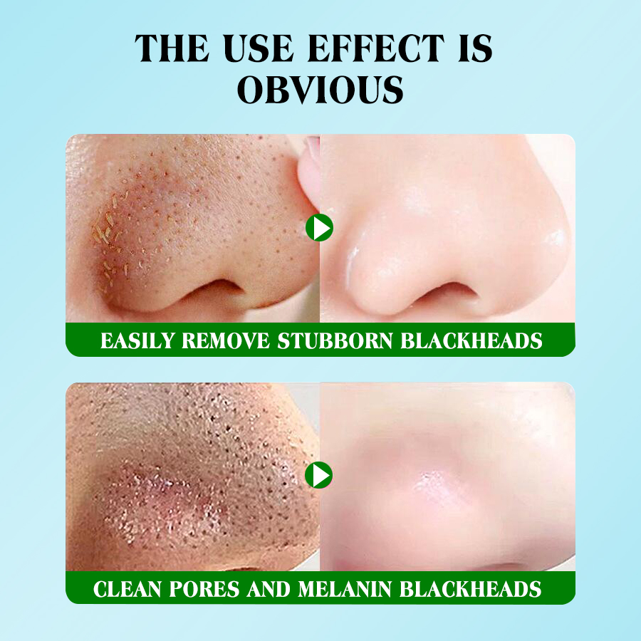 Dear she Snail Essence Extract Deeply cleanses nasal membranes, removes blackheads and whiteheads, and moisturizes and smoothens the skin Application Scenario