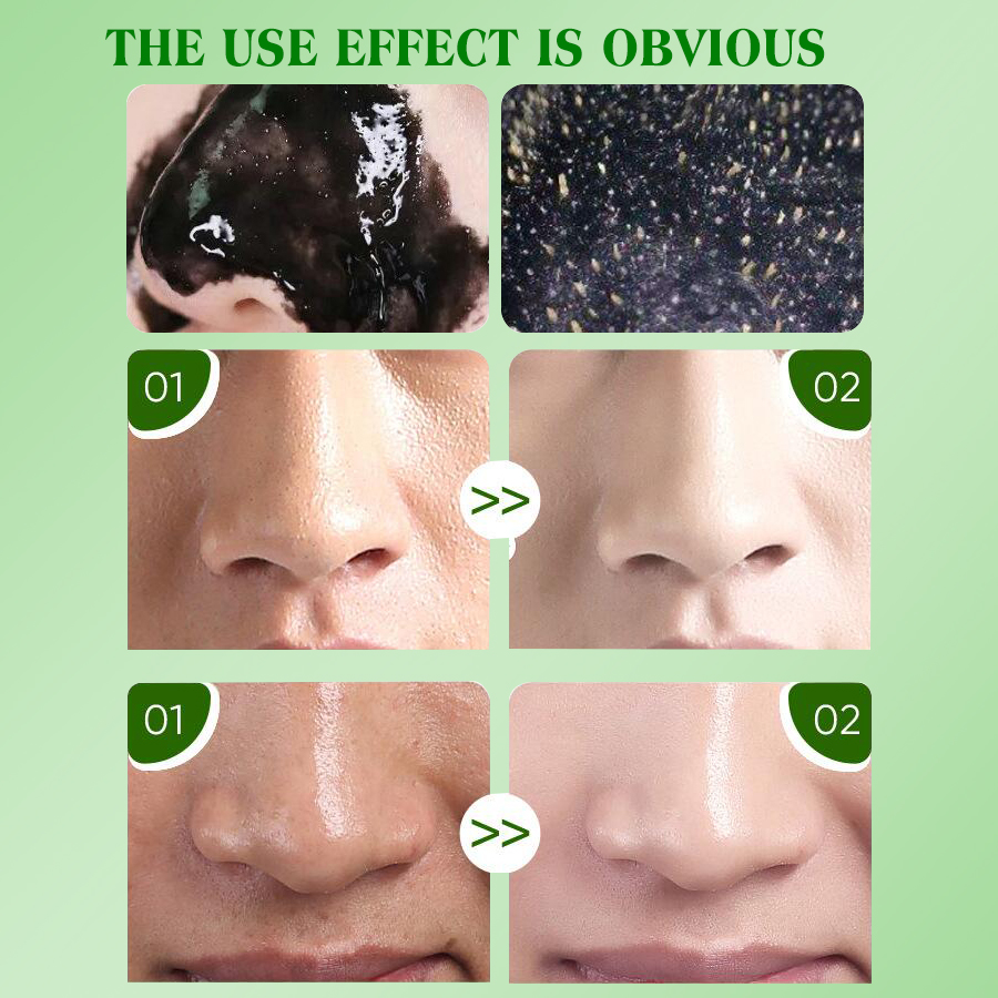 Dear she Bamboo Charcoal Deep Blackhead Removal Nasal Mask Pore Cleansing, Moisturizing, Hydrating and Smooth Nasal Skin Wholesale Item Picture