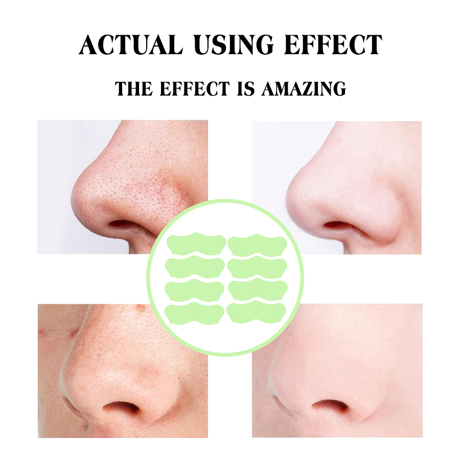 Factory wholesale customized green tea bulk blackhead removal nose patches clean pores, white and black heads, and bid farewell to strawberry noses Application Scenario