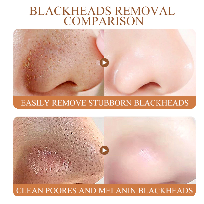 Cross-border foreign trade factory wholesale coffee blackhead removal nose patches clean pores bid farewell to strawberry noses and clean pores Application Scenario