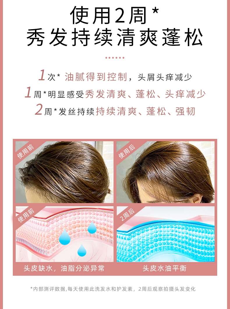 Find A Nourishing Scalp Fluffy Oil Control Shampoo & Conditioner Set Sakura Limited undefined