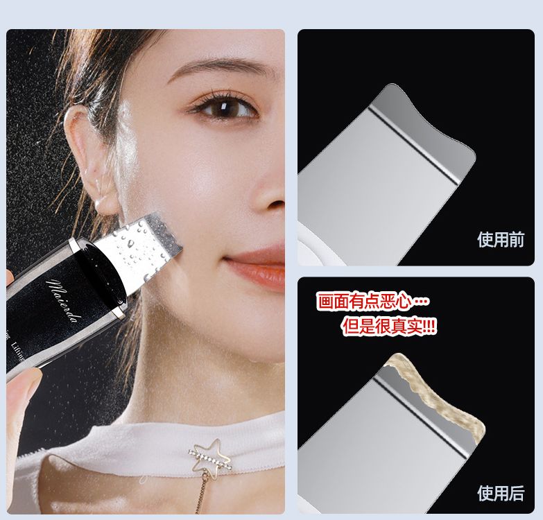 新款超声波铲皮机家用电动离子美容仪细节图