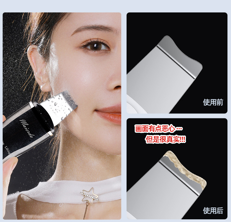 新款超声波铲皮机家用电动离子美容仪详情图4