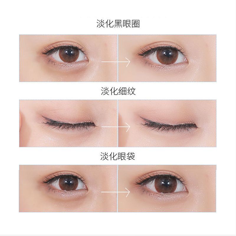 ALOBON Hexapeptide Electric Eye Cream Application Scenario