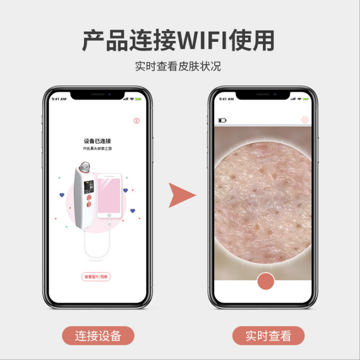 新款无线充可视化黑头仪详情图1