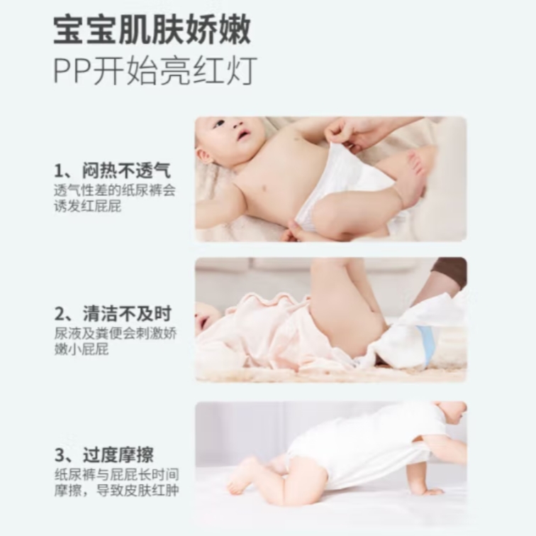 婴童护肤品宝宝化妆品美妆babetrue儿初宝婴儿护臀膏50g详情4