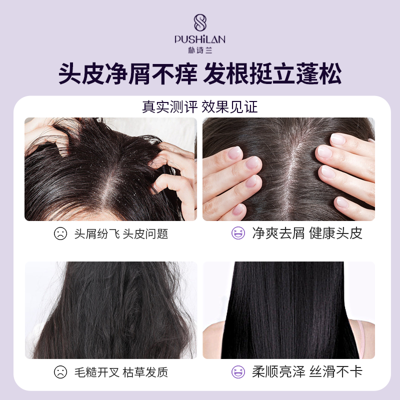 朴诗兰水润去头皮屑去油止痒 健康舒养护头皮 定制香氛洗发露白底实物图
