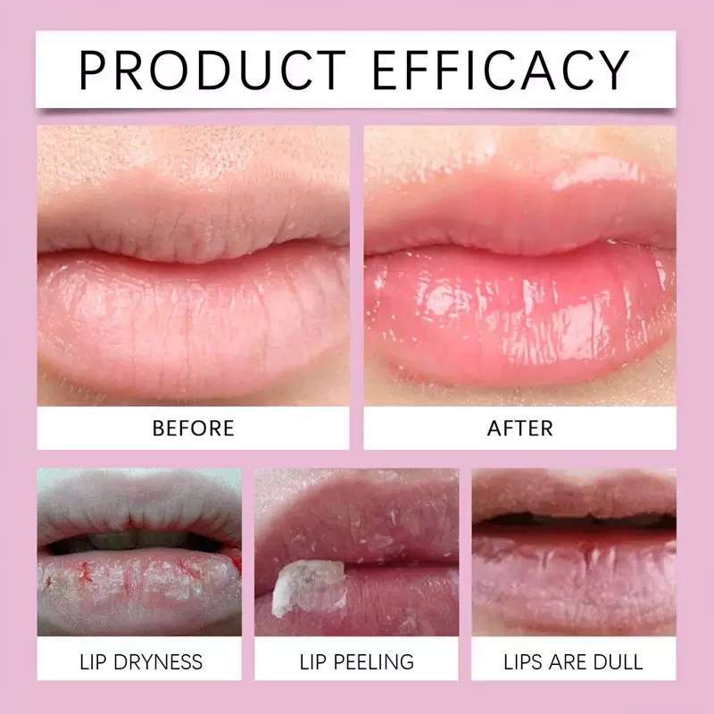 Lip care essence唇部护理精华滋润唇部干燥肌肤淡化唇纹水润光泽品牌润唇膏详情图2