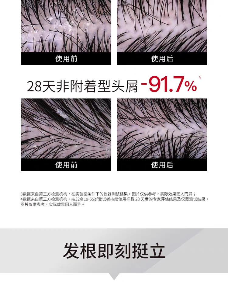 原装进口发玛21蓬松去屑洗发水600ml 无硅油净澈大容量详情图7