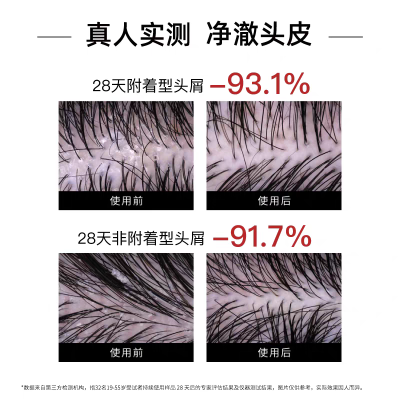 原装进口发玛21蓬松去屑洗发水600ml 无硅油净澈大容量白底实物图