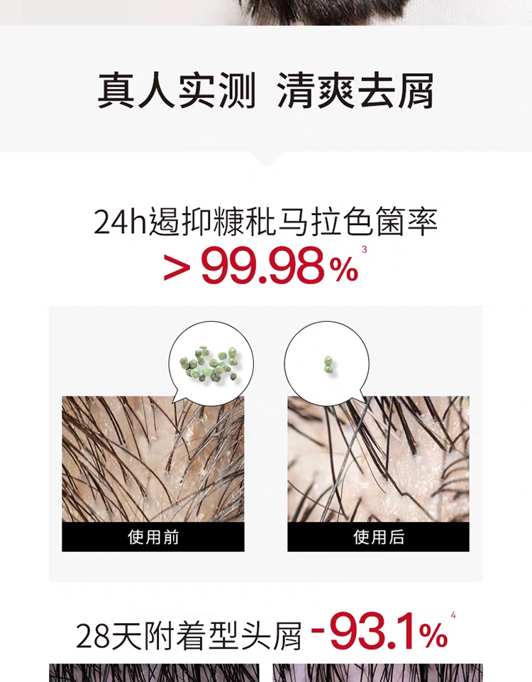 原装进口发玛21蓬松去屑洗发水600ml 无硅油净澈大容量详情图6