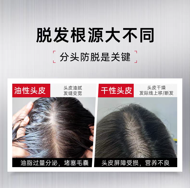 Original imported Capeno Strong Anti-Hair Loss Shampoo 350ml, preventing hair loss, firming hair, controlling oil, preventing hair breakage, thickening hair, and making hair fluffy detail image 7
