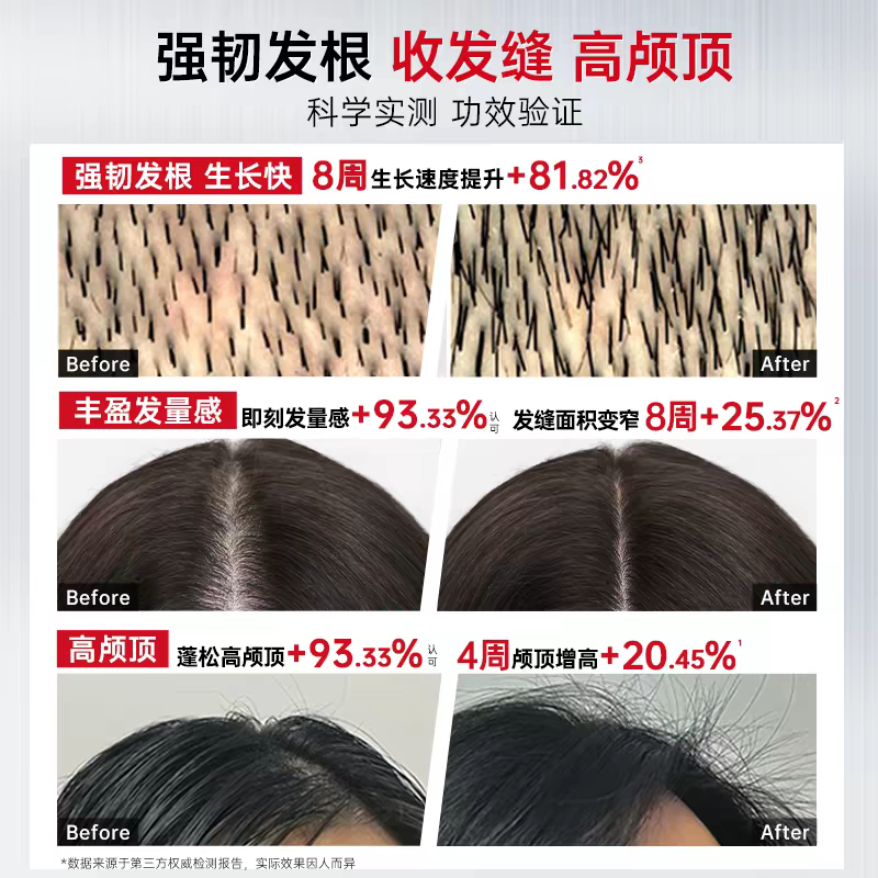 Original imported Capeno Strong Anti-Hair Loss Shampoo 350ml, preventing hair loss, firming hair, controlling oil, preventing hair breakage, thickening hair, and making hair fluffy detail image 6