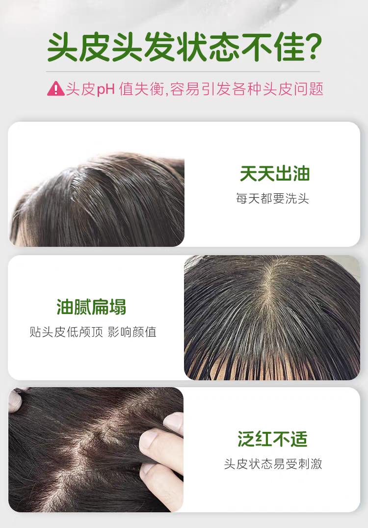 德国sebamed施巴控油养护洗发露400ml无硅油德国进口  男女士清洁护发洗头详情图3