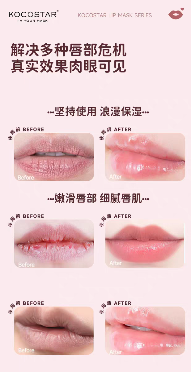 Korean Coco Star Lip Mask (Rose Flavor) 20 pieces of patch hydrogel soft keratin, highly moisturizing and nourishing, moisturizing and improving the lip area detail image 12
